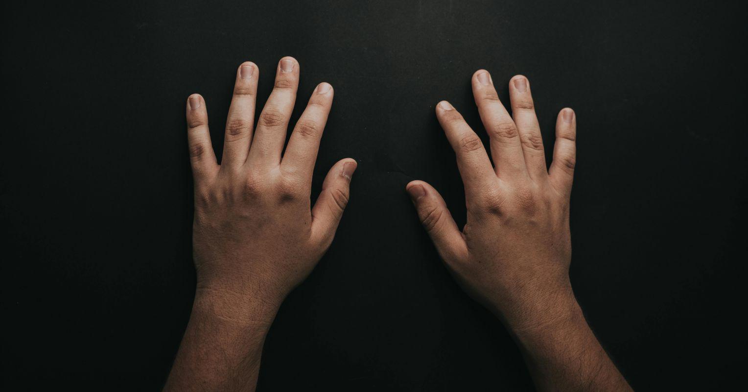 Does Handedness Affect Accidents at Work?