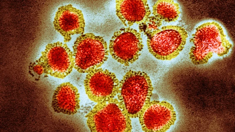 Why this year’s flu season looks to be a bad one