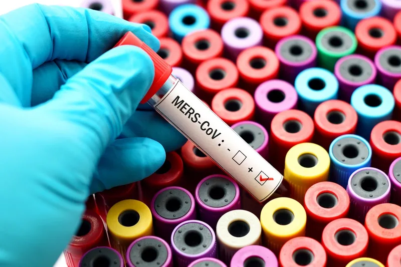 MERS, a Deadly Coronavirus, Resurfaces in France for First Time in 12 Years