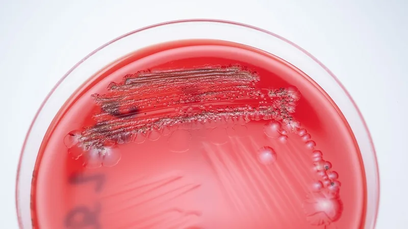 The global hunt to unlock the healing powers of … poop