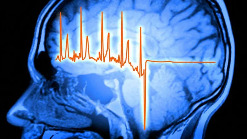 Our brains play a surprising role in recovering from a heart attack