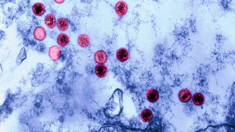 This virus infects most of us – but why do only some get very ill?