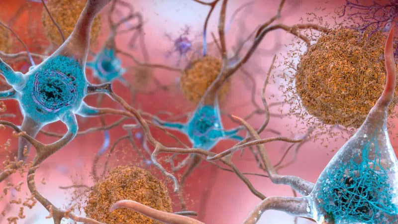Why people can have Alzheimer's-related brain damage but no symptoms
