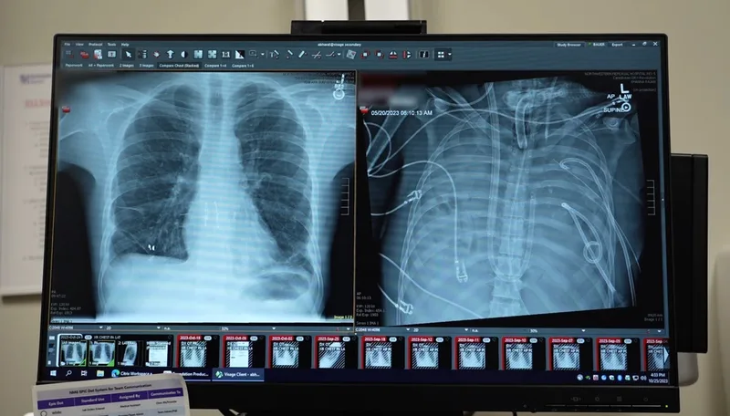 ‘Artificial lungs’ keep patient alive for two days