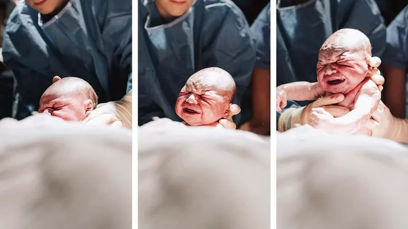 Why is childbirth so hard for humans – and is it getting even harder?