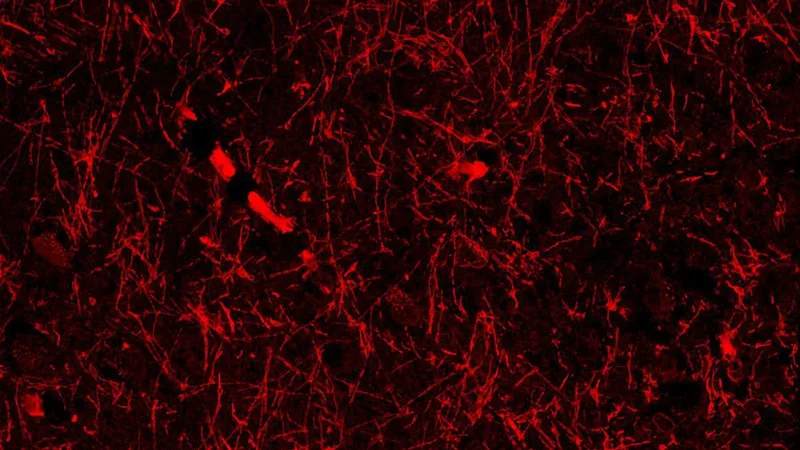 Accidental discovery hints at mystery structures within our brain