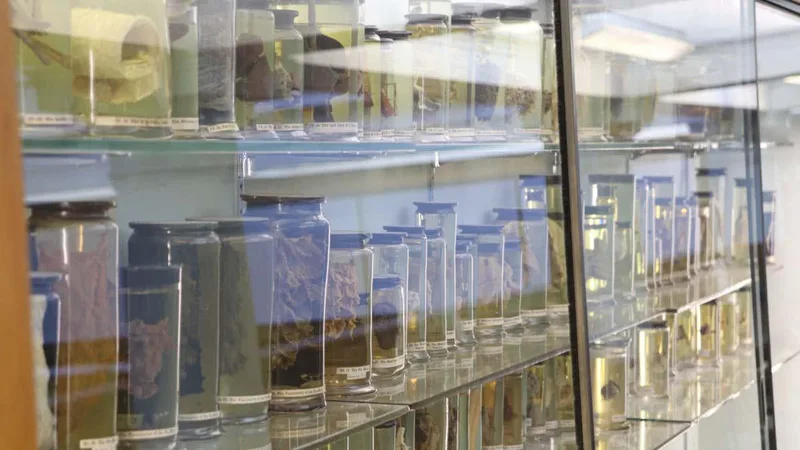 World’s oldest cold virus found in 18th-century woman's lungs
