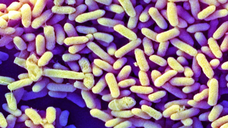 How baby microbiomes in the West differ from those everywhere else