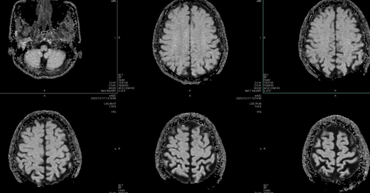 Healthcare Is AI’s Hardest Test