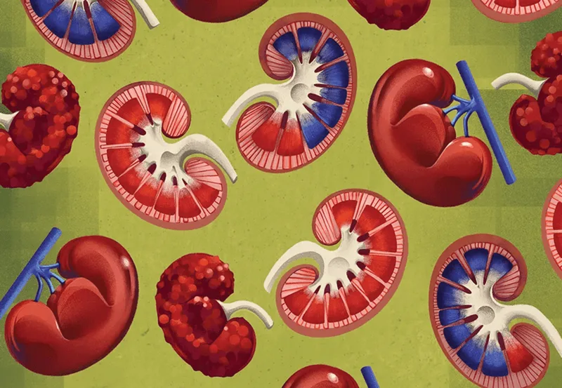 New drugs and treatments transform kidney care