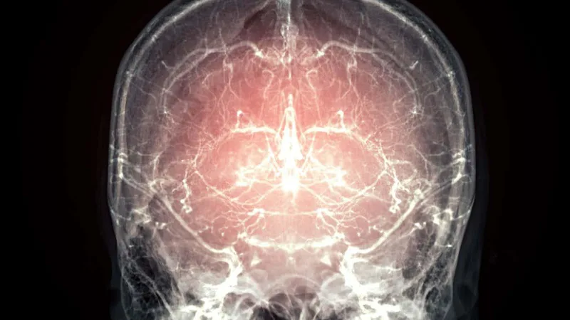 Major leap towards reanimation after death as mammal's brain preserved