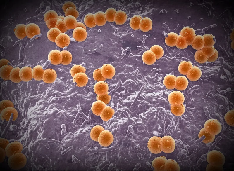 U.K.’s deadly meningitis outbreak shows importance of vaccination