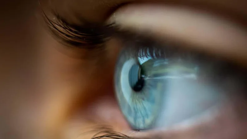 Virus from marine animals is causing weird eye problems in people