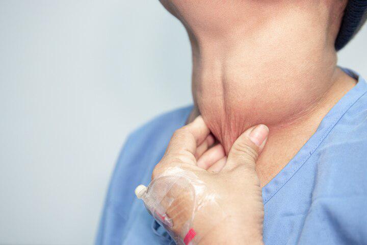 How to check on your thyroid — and why