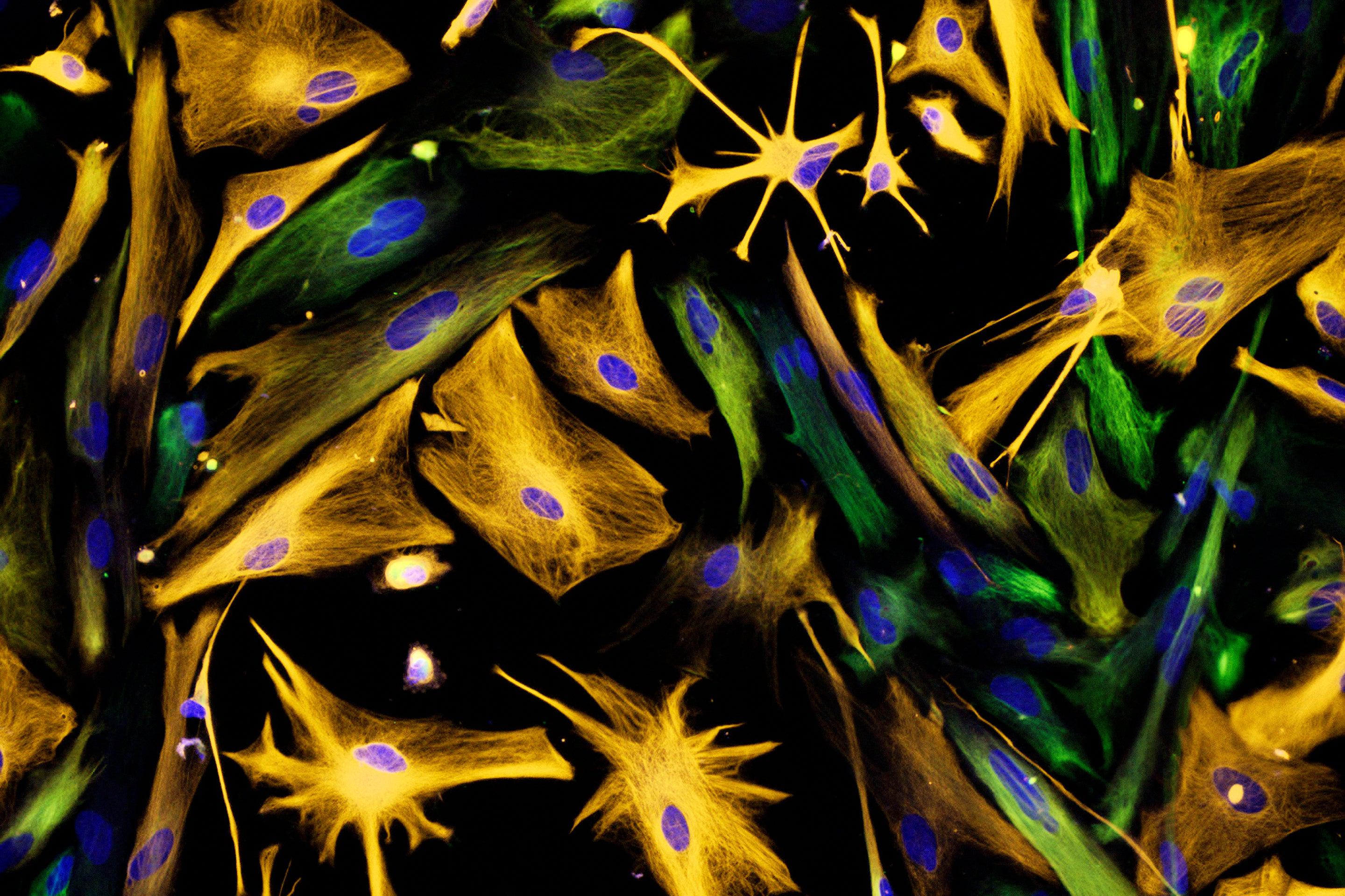 Proof That Adult Brains Make New Neurons Settles Scientific Controversy