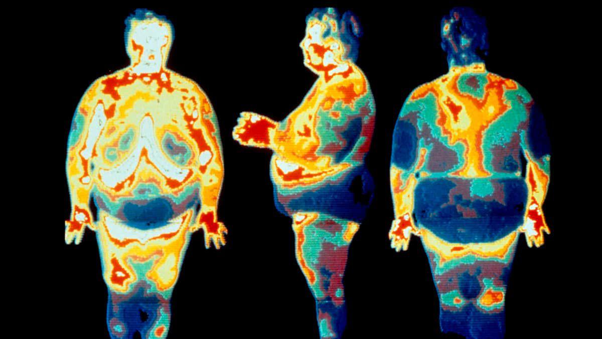 Body fat supports your health in surprisingly complex ways