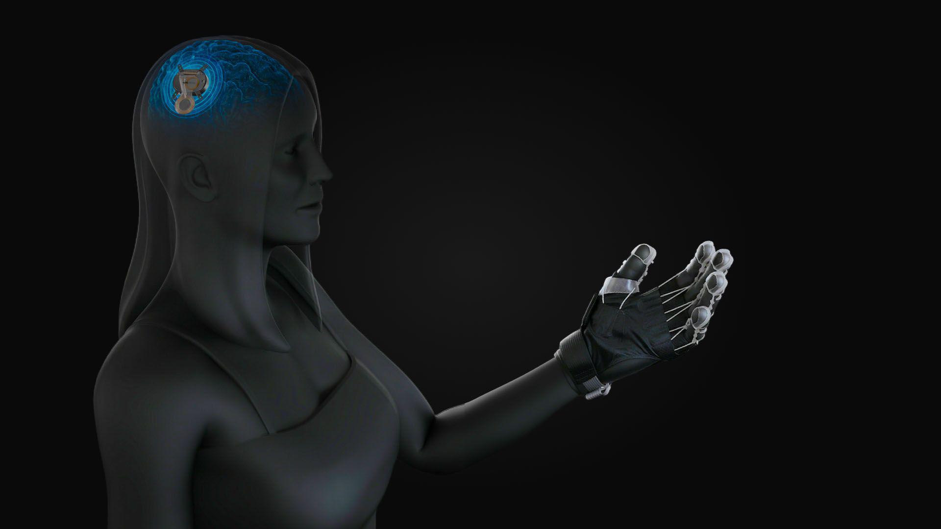 A New Implant Aims to Rewire the Brain to Help Stroke Patients