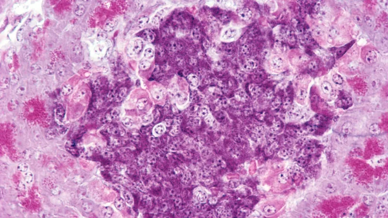 Scientists cure type 1 diabetes in mice