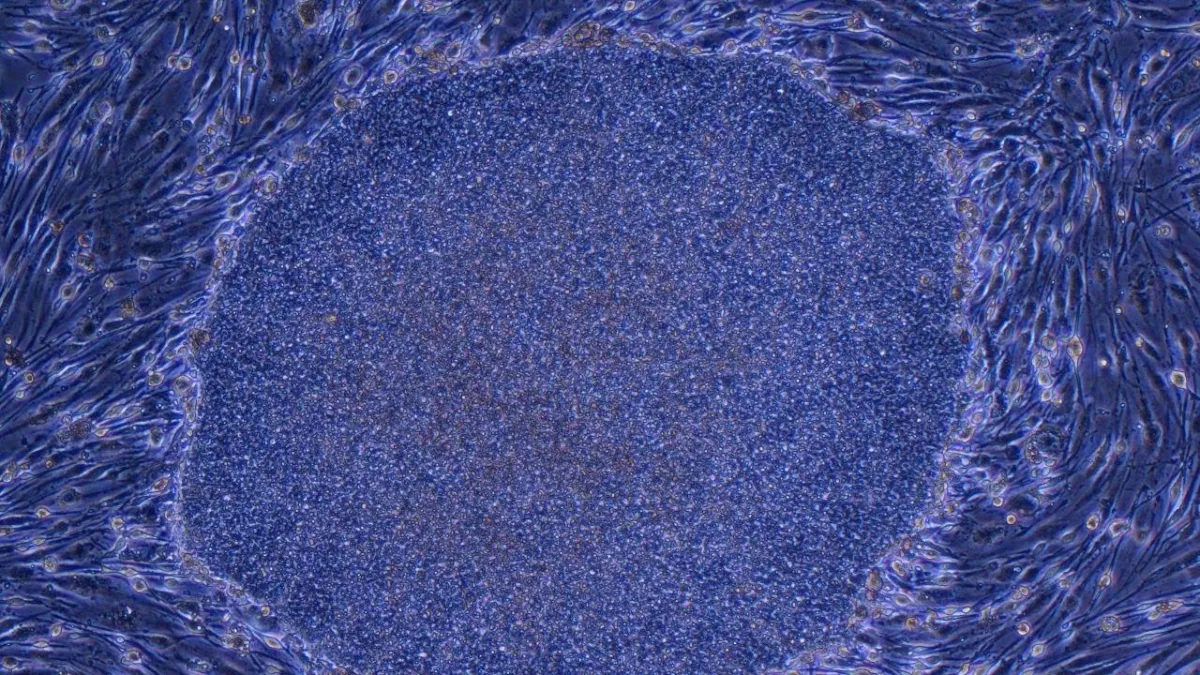 Japan Approves the World’s First Treatment Made With Reprogrammed Human Cells