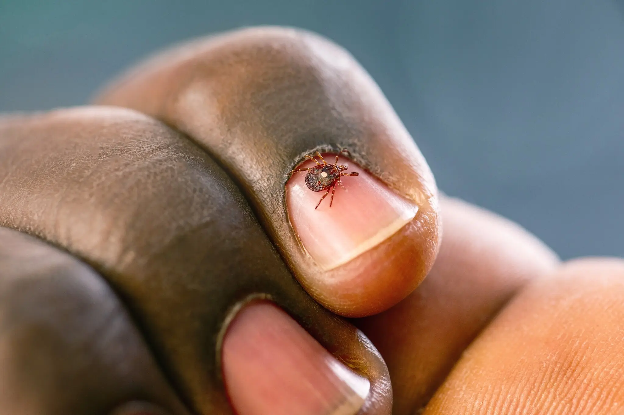 It’s Already a Bad Tick Season. Here’s How to Protect Yourself.