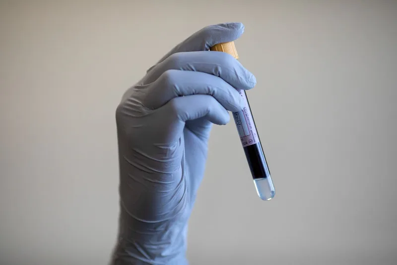 Alzheimer's blood tests may predict when a person will develop symptoms