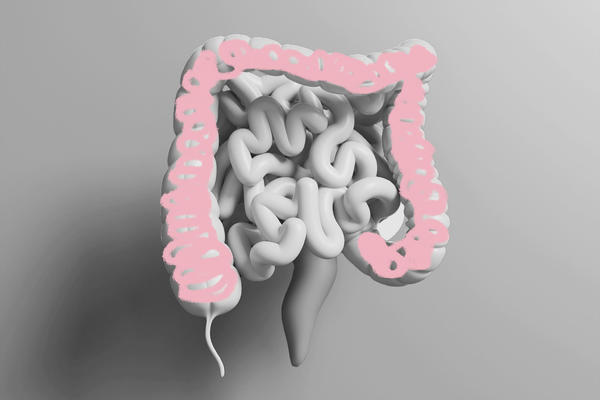 Reasons you should get a colonoscopy earlier than recommended