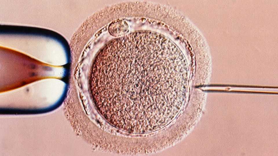 Do high-tech “add-ons” increase the chance that IVF will work?