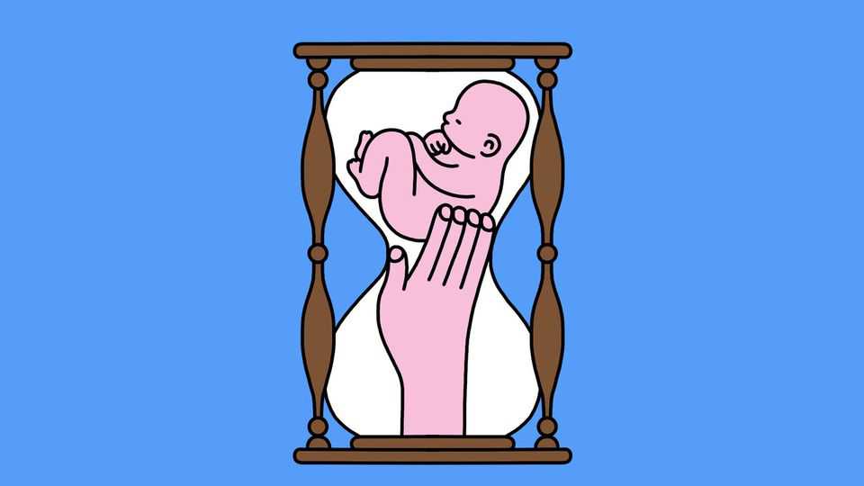 Does being induced lead to a medicalised birth?