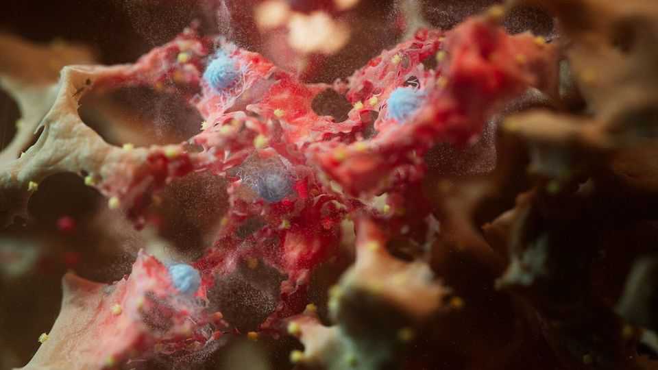 New techniques can predict and prevent lung cancer