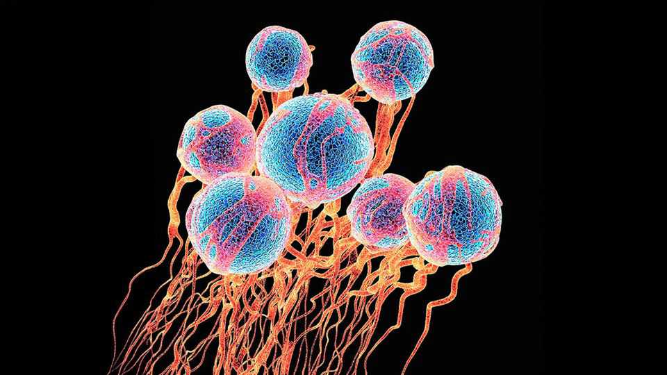 Will one-stop blood tests for cancer save lives?