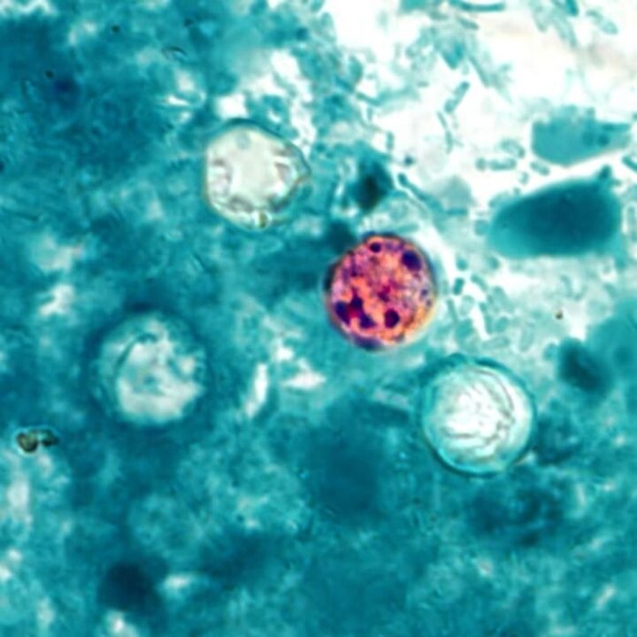 What is cyclospora? Here’s how the parasite spreads
