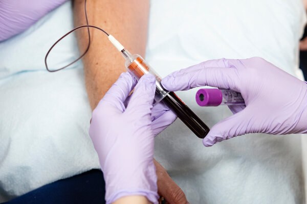 What to Know About the Powerful New Cholesterol Pill