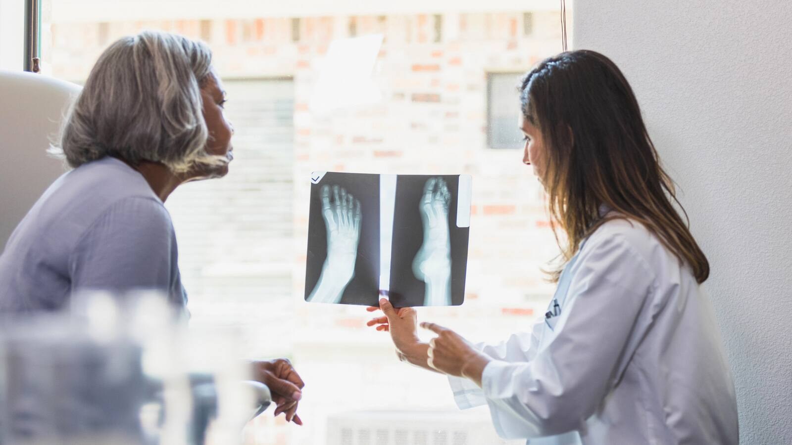 Concerned you have bone thinning? Here’s what experts recommend.